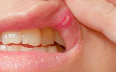 Oral Pathology with best smile dental clinic Trivandrum